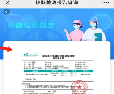 为什么手机上查不到检验报告